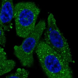 TPD52L2/D54 Antibody, Novus Biologicals 0.1mL; Unlabeled:Antibodies, Polyclonal